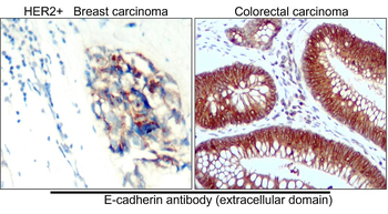 E-cadherin (Extracellular) Antibody