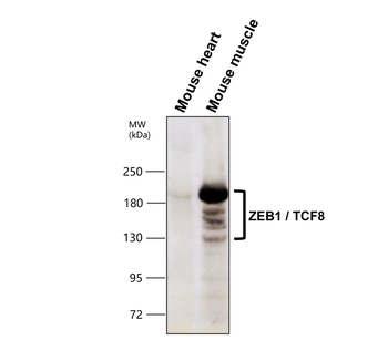 ZEB1 Antibody