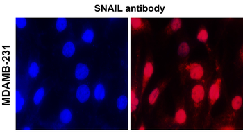 ZEB1 Antibody