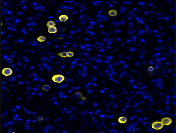 N-cadherin (Extracellular) Rabbit Polyclonal Antibody