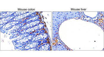 Vimentin Antibody