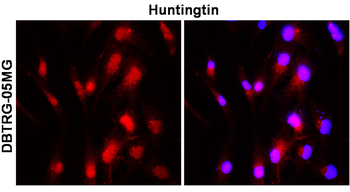 Huntingtin Rabbit Polyclonal Antibody
