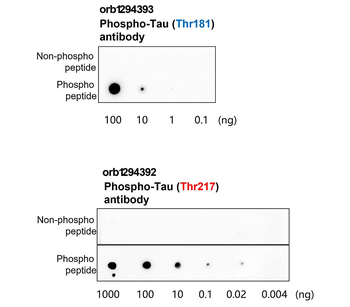 Phospho-Tau (Thr217) Rabbit Polyclonal Antibody