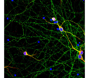 Phospho-Tau (Thr181) Antibody