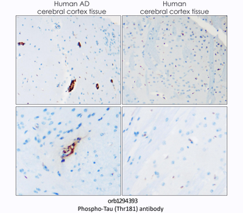 Phospho-Tau (Thr181) Antibody