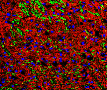 Phospho-Tau (Thr181) Antibody