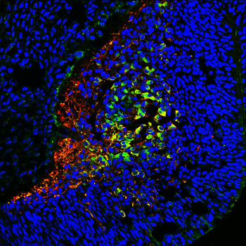 Tau Antibody
