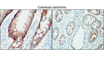 NaK ATPase alpha 1/ATP1A1 Antibody