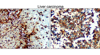 VDAC1/Porin Antibody