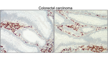 AIF/Iba1 Antibody