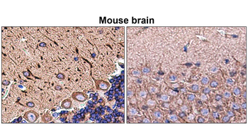 MAP2 Rabbit Polyclonal Antibody