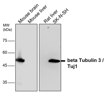 Beta Tubulin 3 Rabbit Polyclonal Antibody