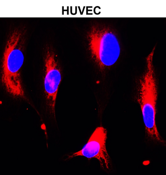 Beta Tubulin 3 Rabbit Polyclonal Antibody