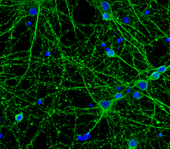 Beta Tubulin 3 Rabbit Polyclonal Antibody