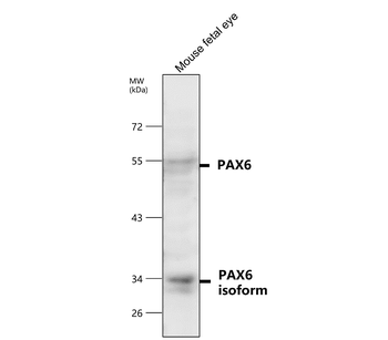 PAX6 Rabbit Polyclonal Antibody