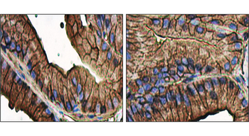 Beta-actin Rabbit Polyclonal Antibody