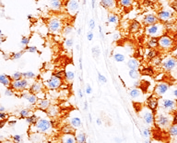 Vinculin Antibody