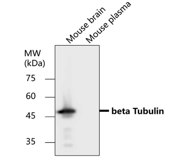 Beta-tubulin Rabbit Polyclonal Antibody