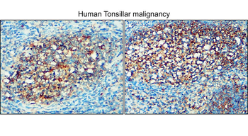 Enolase-2/ENO2 Antibody