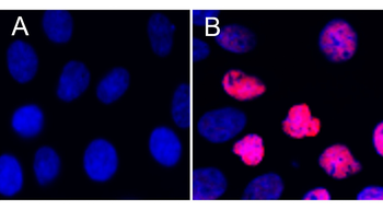 STAT3 Phospho (Tyr705) Mouse Monoclonal Antibody