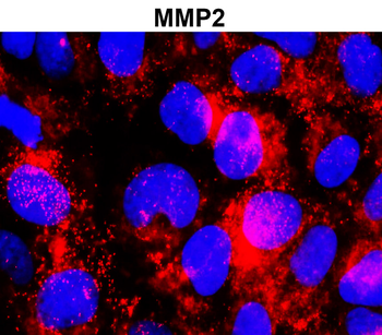 MMP2 c-term Rabbit Polyclonal Antibody