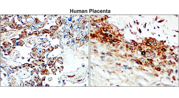 MMP2 c-term Rabbit Polyclonal Antibody
