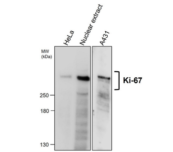 KI-67 Antibody