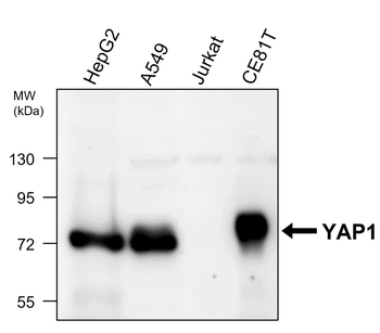 YAP1 Rabbit Polyclonal Antibody