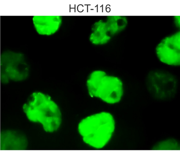 p53 Mouse Monoclonal Antibody