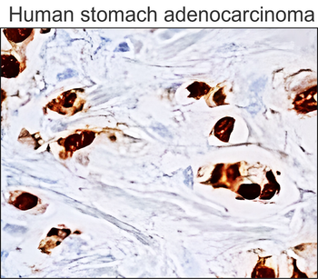 p53 Mouse Monoclonal Antibody