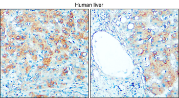 TGF beta 1 Rabbit Polyclonal Antibody