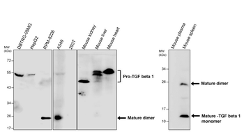 TGF beta 1 Rabbit Polyclonal Antibody