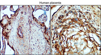 Collagen II /COL2A1 Antibody