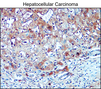 Collagen II /COL2A1 Antibody