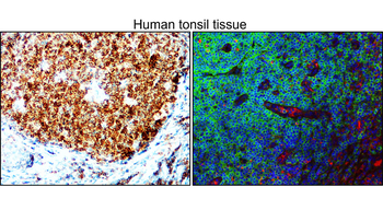 Human CD45 Mouse Monoclonal Antibody