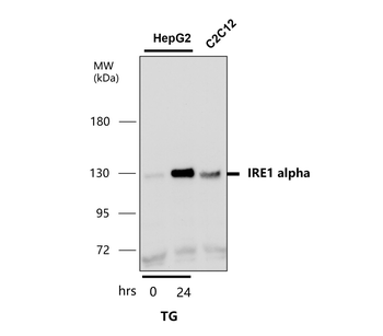 Endoplasmic Reticulum / ER  Stress Antibody Panel