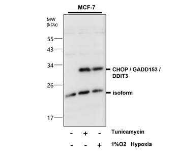 Endoplasmic Reticulum / ER  Stress Antibody Panel
