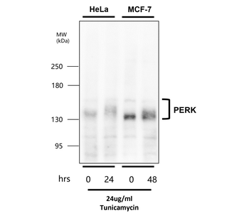 Endoplasmic Reticulum / ER Stress Antibody Panel
