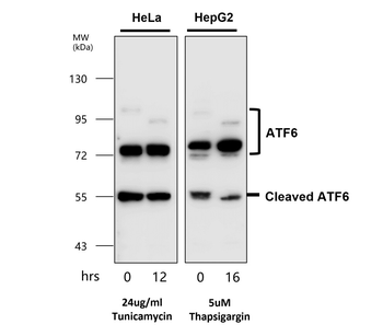 Endoplasmic Reticulum / ER Stress Antibody Panel