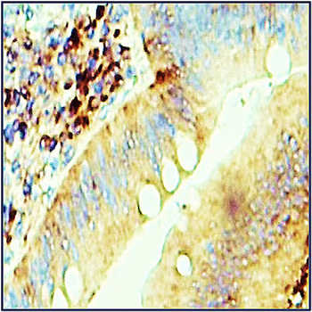 Extracellular Matrix / ECM Profiling Antibody Panel