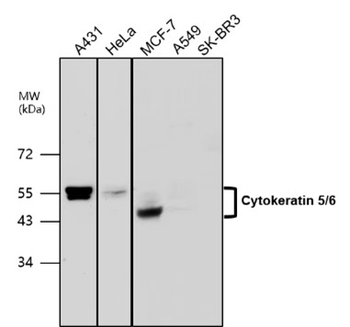 Cytokeratin Antibody Panel