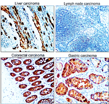 Cytokeratin Antibody Panel
