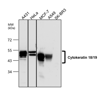 Cytokeratin Antibody Panel