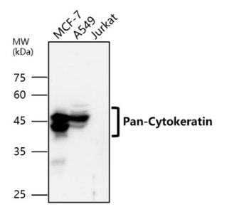 Cytokeratin Antibody Panel