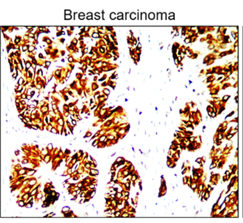 Cytokeratin Antibody Panel