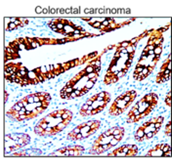 Cytokeratin Antibody Panel