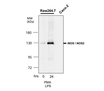 Inflammation Antibody Panel