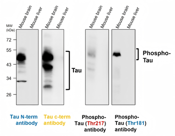 Tau Alzheimer's disease Antibody Panel
