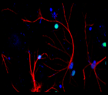 Neuroinflammation Antibody Panel