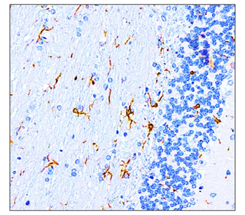 Neuroinflammation Antibody Panel